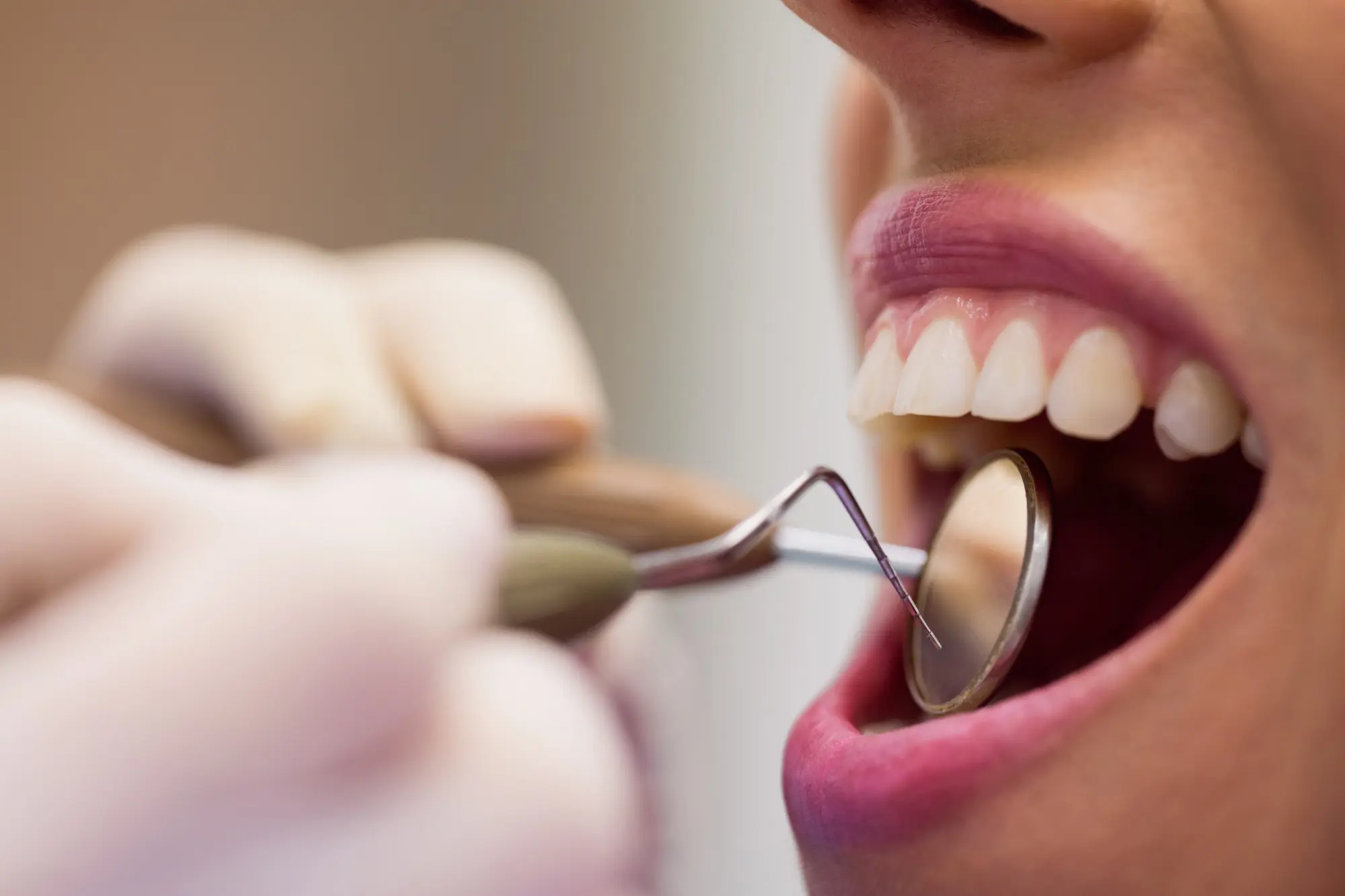 Custom Orthodontic Appliances and Dental Ceramics